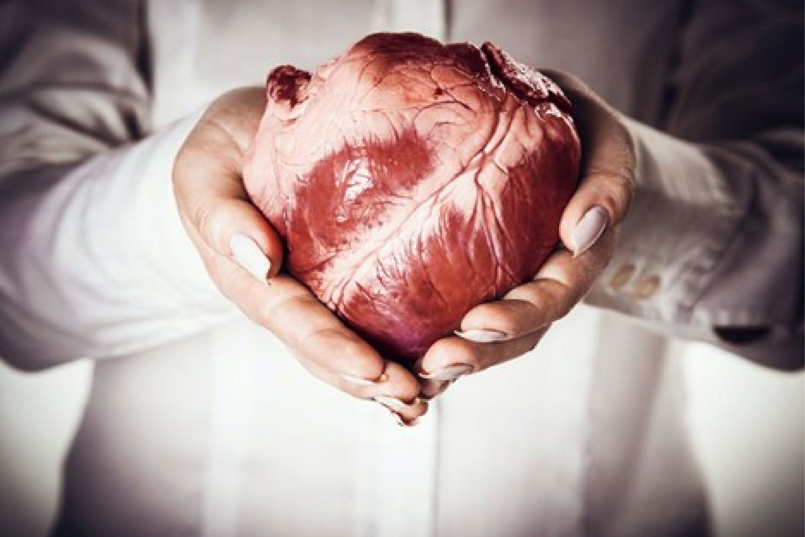 SIDS Hospital-organ transplant